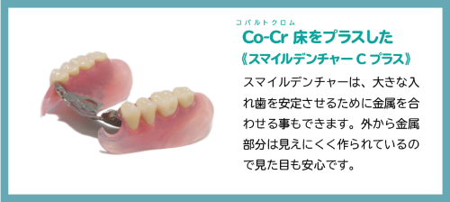 コバルトクロムの金属床により薄く丈夫になったスマイルデンチャー