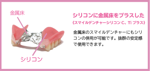 シリコンの優しさと金属床の丈夫さを兼ね備えたスマイルデンチャー