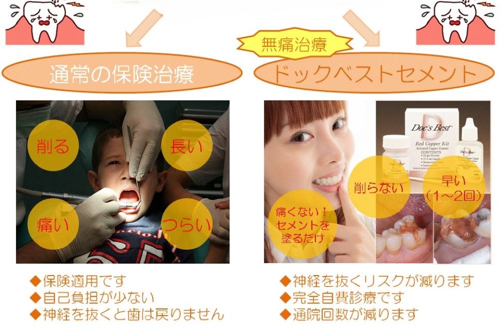 通常の治療とドックベストセメント治療の違い