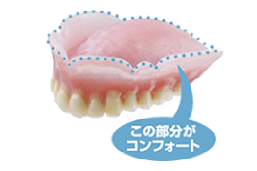 裏面に生体用シリコンを貼り付け、痛みを軽減するコンフォートデンチャー
