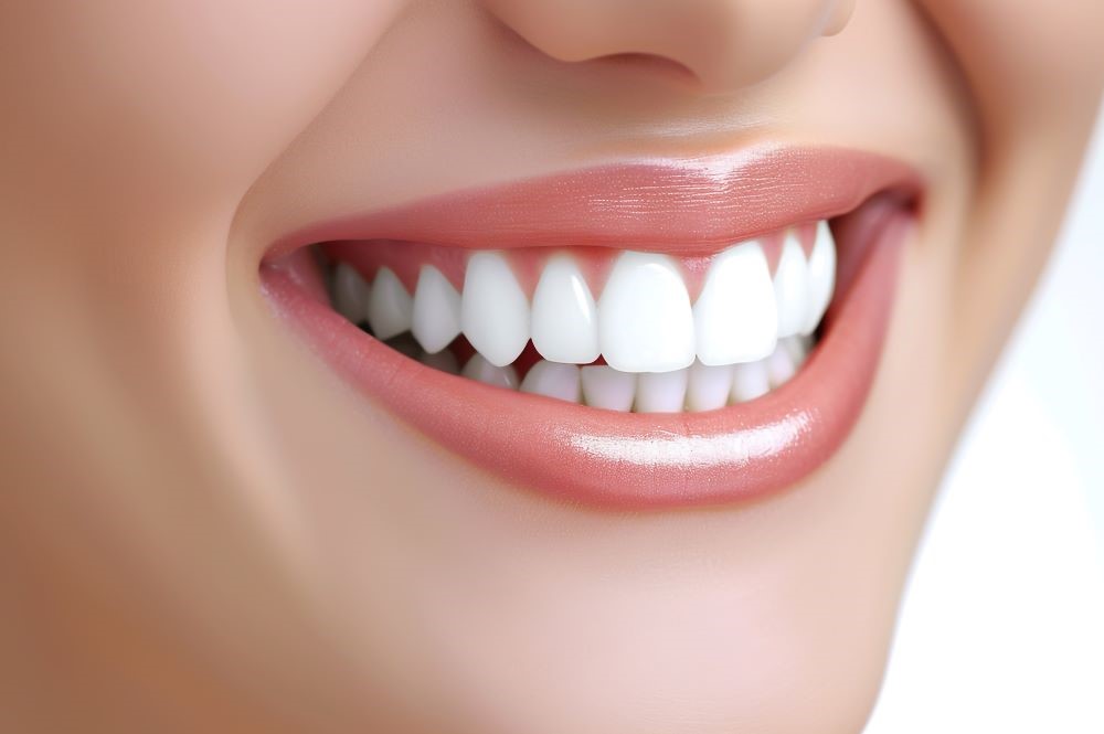 審美歯科で白い歯で笑顔を見せる女性の口元