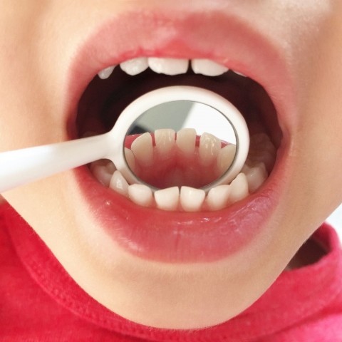 歯科医師が患者の口内をチェックする定期健診の様子