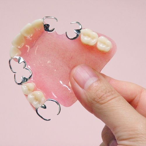 形が合わず調整が必要な入れ歯を示す画像