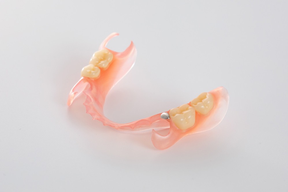 金属の見えない入れ歯スマイルデンチャーの紹介へのリンク画像